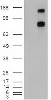 m00441 anti ptch1 mouse monoclonal antibody clone id oti5c7 wb testing 1