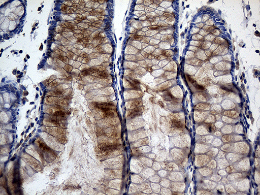 Immunohistochemical staining of paraffin-embedded Human colon tissue within the normal limits using anti-TANK mouse monoclonal antibody