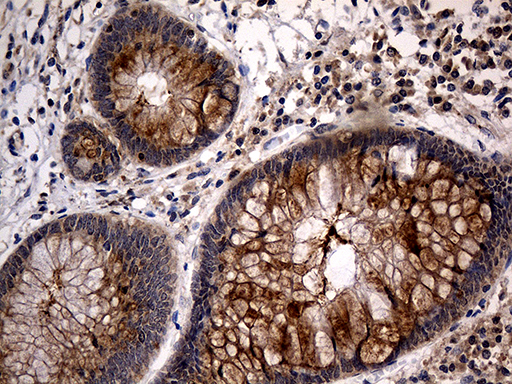 m00445 anti tank mouse monoclonal antibody clone id oti1g2 ihc testing 5