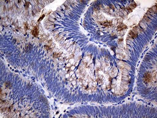 m00445 anti tank mouse monoclonal antibody clone id oti1g2 ihc testing 6