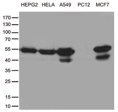 Western blot analysis of extracts (35ug) from cell lines by using anti-TANK monoclonal antibody (1:500)