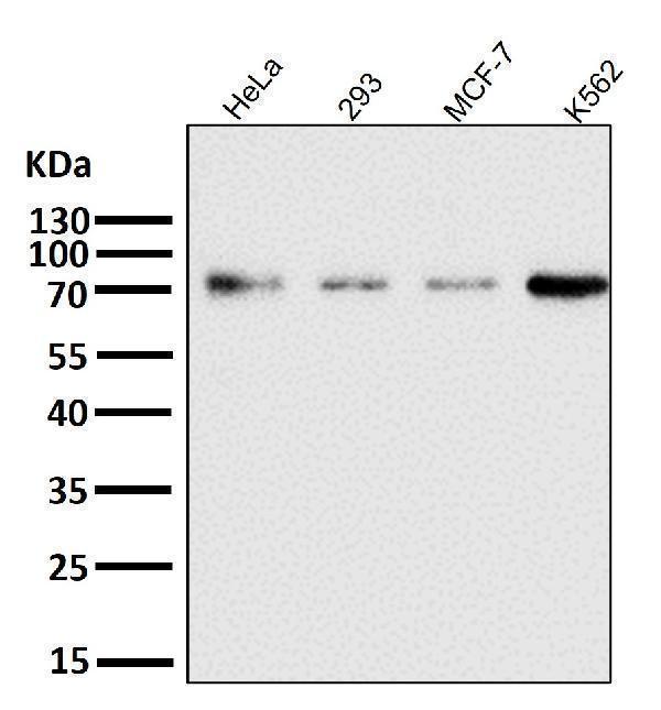 All lanes use the Antibody at 1:1K dilution for 1 hour at room temperature