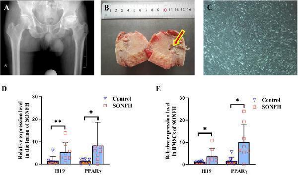 H19 and PPARγ are upregulated in the femoral head and BMSCs of patients with SONFH