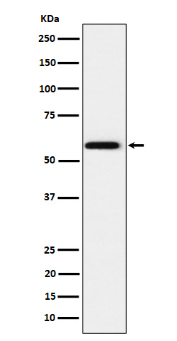 Western blot analysis of PPAR gamma expression in HeLa cell lysate