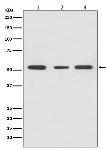 Western blot analysis of PPAR gamma expression in (1) HeLa cell lysate; (2) PC-3 cell lysate; (3) THP-1 cell lysate
