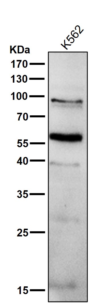 All lanes use the Antibody at 1:1K dilution for 1 hour at room temperature