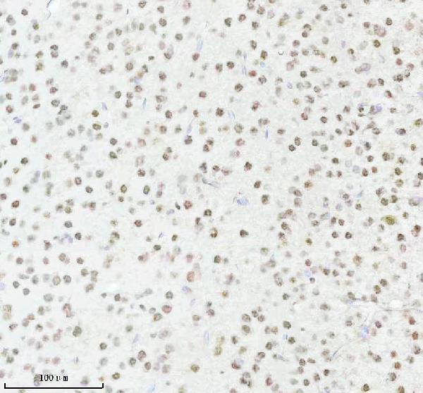 m00450s125 p npm1 primary antibodies ihc testing 10