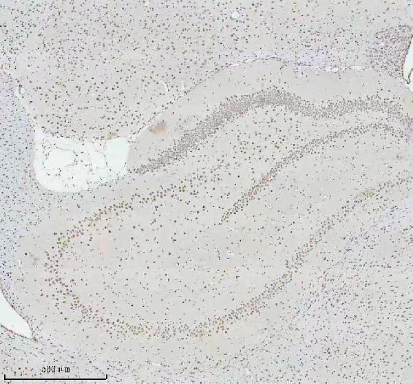 m00450s125 p npm1 primary antibodies ihc testing 11