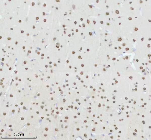 m00450s125 p npm1 primary antibodies ihc testing 12