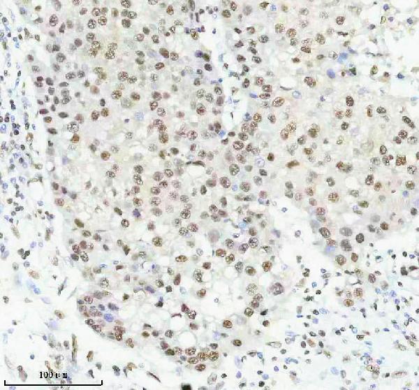 m00450s125 p npm1 primary antibodies ihc testing 3