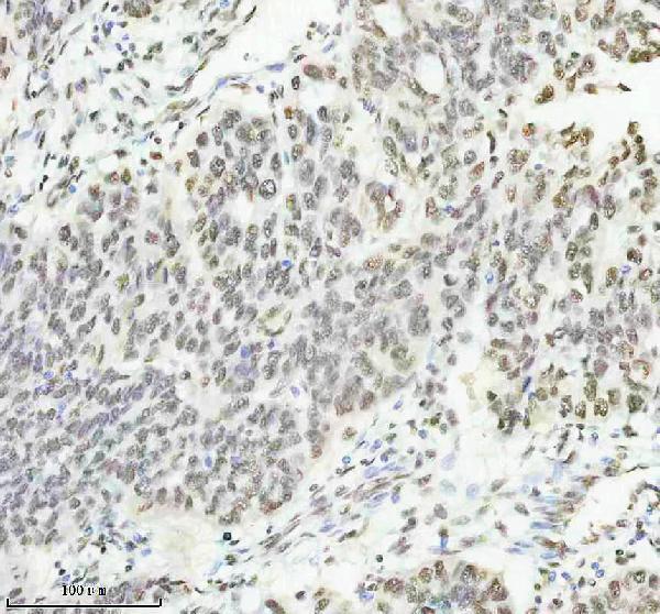 m00450s125 p npm1 primary antibodies ihc testing 4