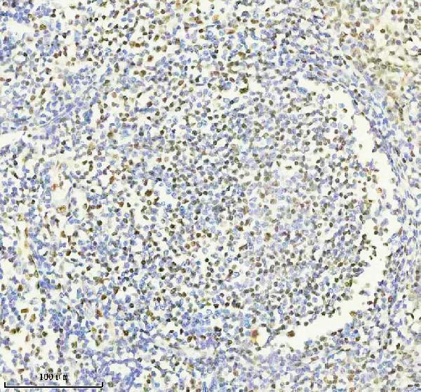 m00450s125 p npm1 primary antibodies ihc testing 5