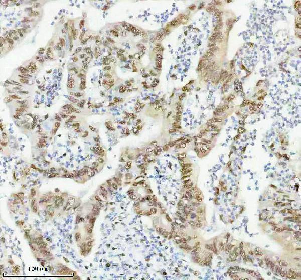 m00450s125 p npm1 primary antibodies ihc testing 6
