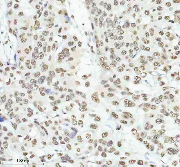 m00450s125 p npm1 primary antibodies ihc testing 7