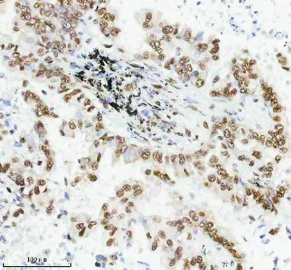 m00450s125 p npm1 primary antibodies ihc testing 8