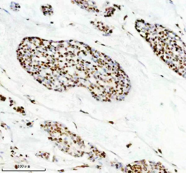 m00450s125 p npm1 primary antibodies ihc testing 9