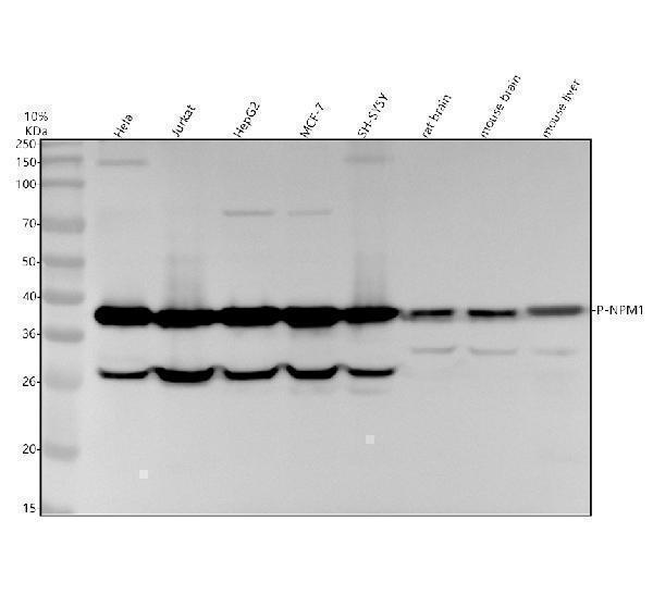Western blot analysis of P-NPM1 using anti-P-NPM1 antibody (M00450S125)