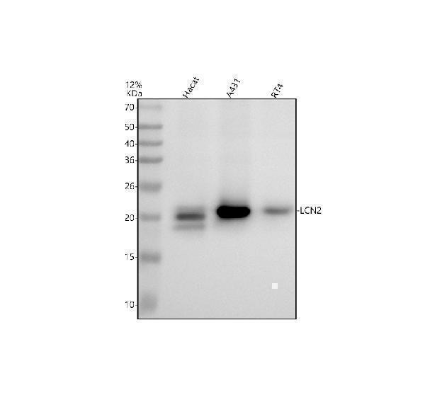 Western blot analysis of LCN2 using anti-LCN2 antibody (M00452)