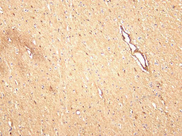 Human brain was stained with anti-PAK1 rabbit antibody