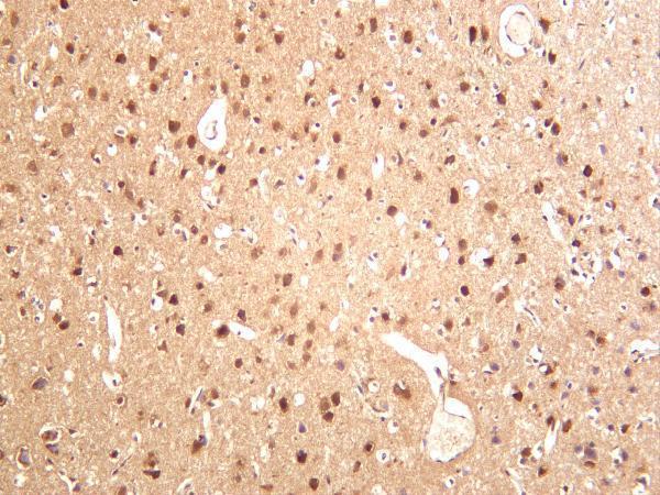 Rat brain was stained with anti-PAK1 rabbit antibody