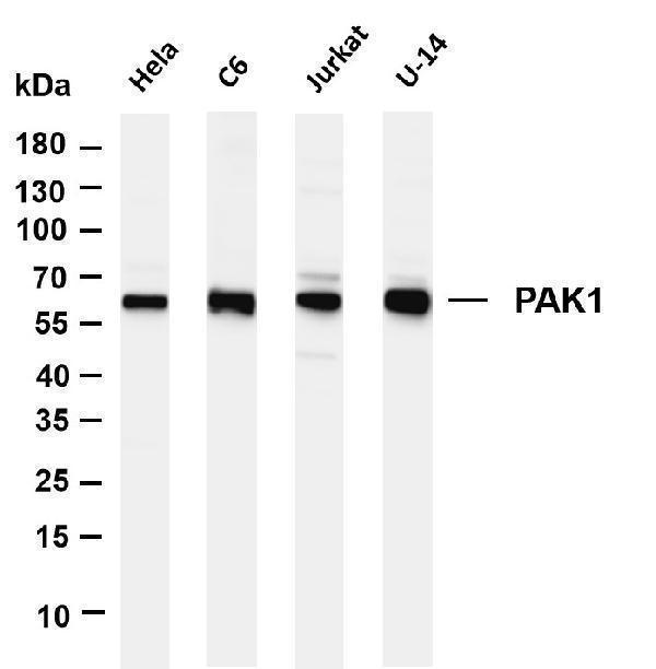 m00454 1 pak1 primary antibodies wb testing 1