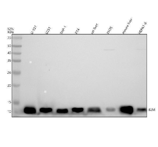 Western blot analysis of Beta-2 Microglobulin/B2M using anti-Beta-2 Microglobulin/B2M antibody (M00456-1)