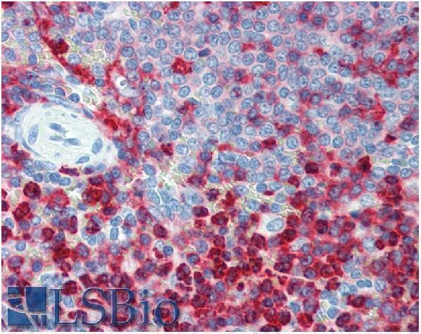 m00458 2 hu cd18 primary antibodies ihc testing 2