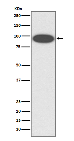 Western blot analysis of CD18 expression in K562 cell lysate