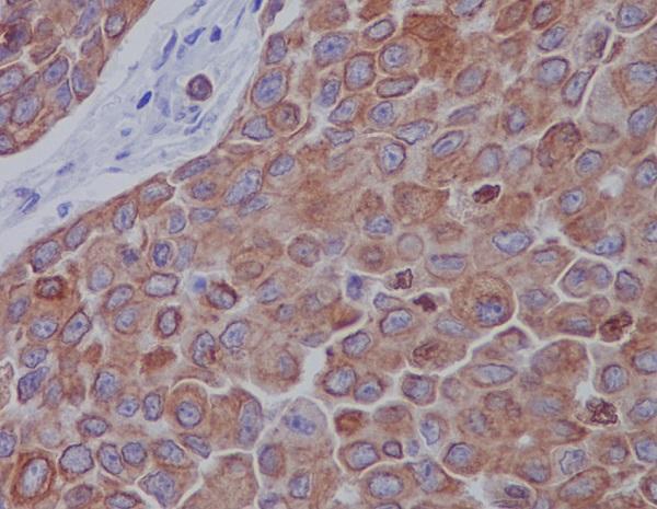 m00461 ihc