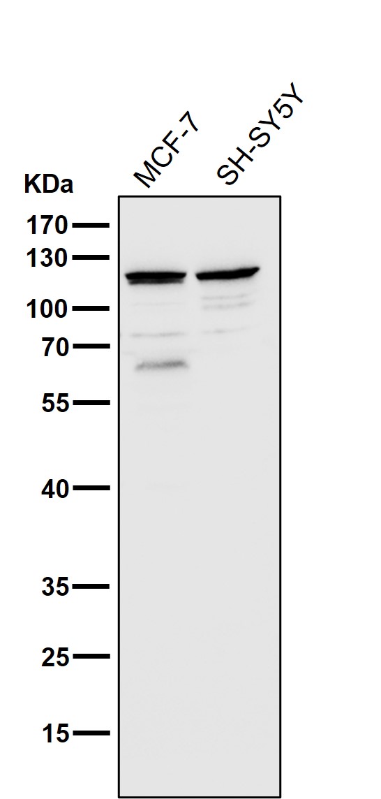 All lanes use the Antibody at 1:2K dilution for 1 hour at room temperature