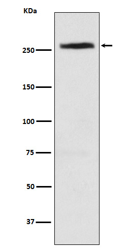 Western blot analysis of CAD expression in HeLa cell lysate