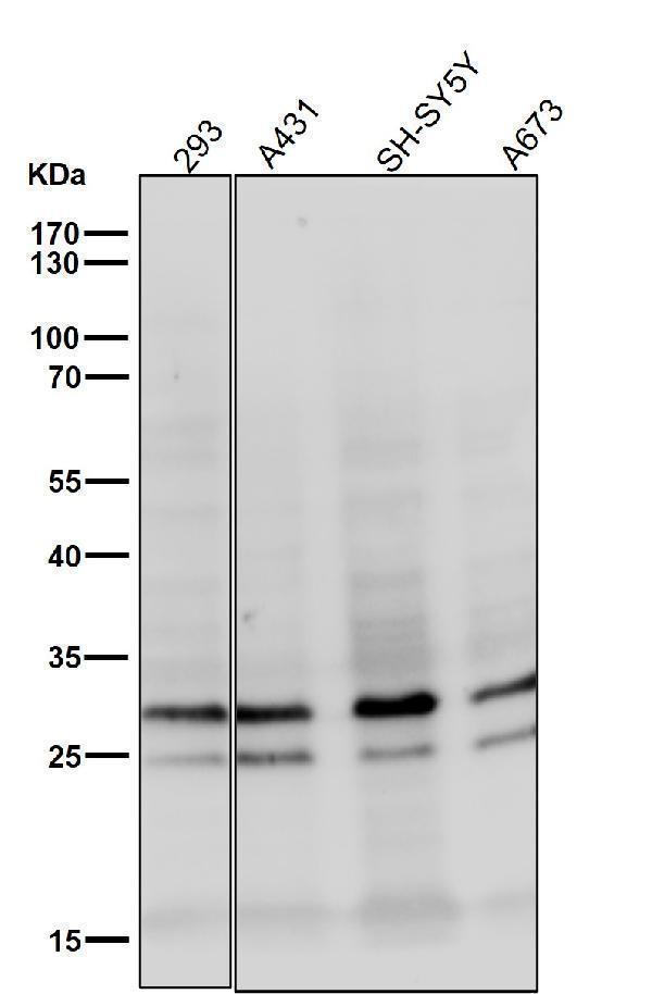 All lanes use the Antibody at 1:1K dilution for 1 hour at room temperature