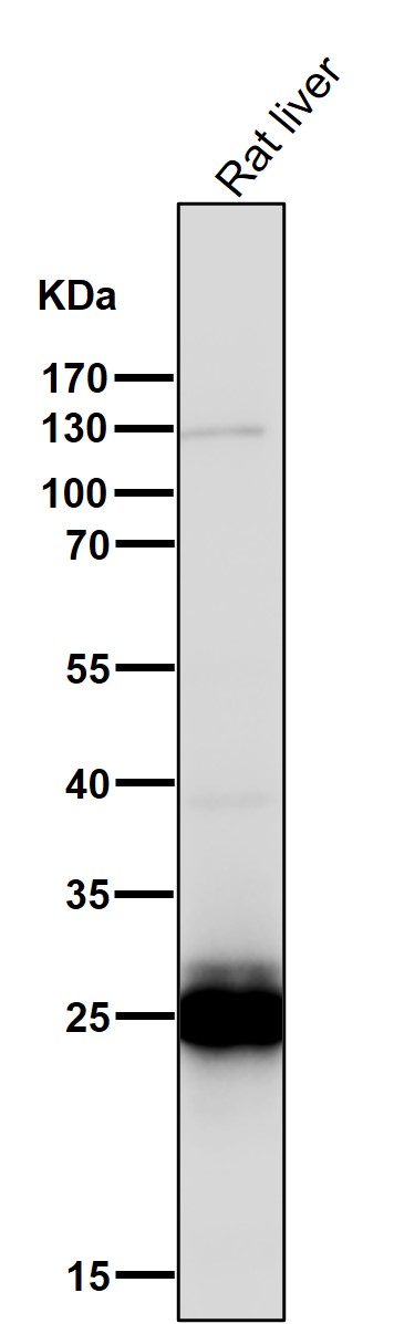All lanes use the Antibody at 1:1K dilution for 1 hour at room temperature