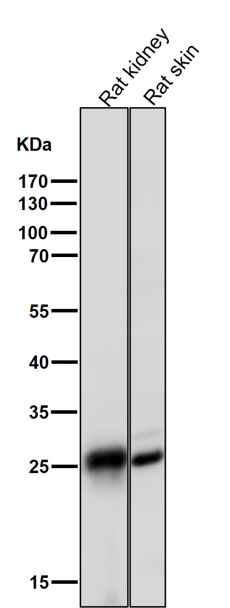 All lanes use the Antibody at 1:1K dilution for 1 hour at room temperature