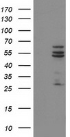 HEK293T cells were transfected with the pCMV6-ENTRY control (Left lane) or pCMV6-ENTRY CYP2C9 (Right lane) cDNA for 48 hrs and lysed