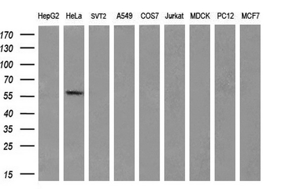 Western blot analysis of extracts (35ug) from 9 different cell lines by using anti-CYP2C9 monoclonal antibody (HepG2: human; HeLa: human; SVT2: mouse; A549: human; COS7: monkey; Jurkat: human; MDCK: canine; PC12: rat; MCF7: human) (1:200)