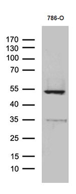 m00466 anti trail tnfsf10 mouse monoclonal antibody clone id oti9a8 wb testing 2