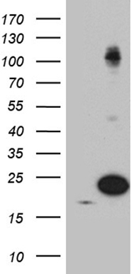 HEK293T cells were transfected with the pCMV6-ENTRY control (Left lane) or pCMV6-ENTRY PIN1 (Right lane) cDNA for 48 hrs and lysed