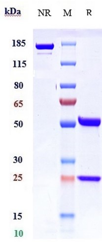 m00468 3 sds page