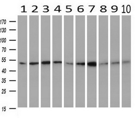 Western blot analysis of extracts (10ug) from 10 Human tissue by using anti-SERPINC1 monoclonal antibody at 1:500 (1: Testis; 2: Omentum; 3: Uterus; 4: Breast; 5: Brain; 6: Liver; 7: Ovary; 8: Thyroid gland; 9: colon;10: spleen)