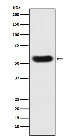 Western blot analysis of SERPINC1 expression in human plasma lysate