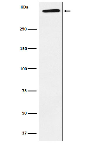 Western blot analysis of ApoA expression in Human plasma lysate