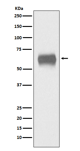 Western blot analysis of CD5 expression in human plasma lysate
