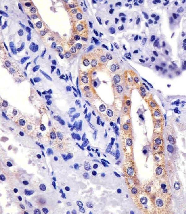 m00482 anti xiap antibody ihc p testing 3