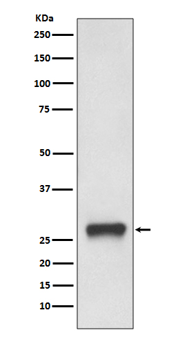 Western blot analysis of MHC Class II expression in Daudi cell lysate