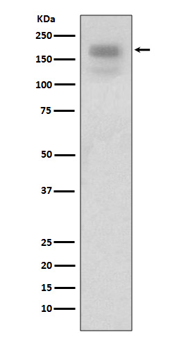 Western blot analysis of MERTK expression in  HEK293 cell lysates