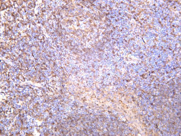 Human spleen was stained with anti-Syk rabbit antibody