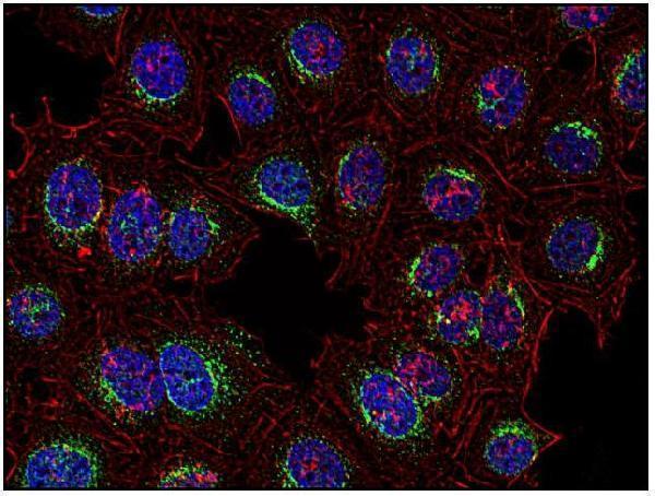 Immunocytochemistry analysis of Syk in human HeLa cell line using anti-Syk (SYK-01; green)