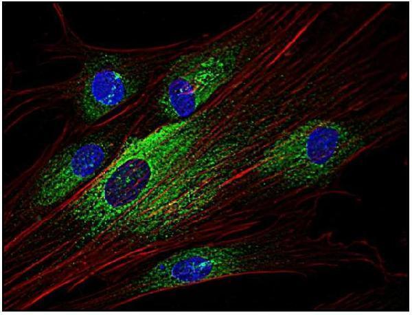 Immunocytochemistry analysis of Syk in human primary fibroblasts using anti-Syk (SYK-01; green)