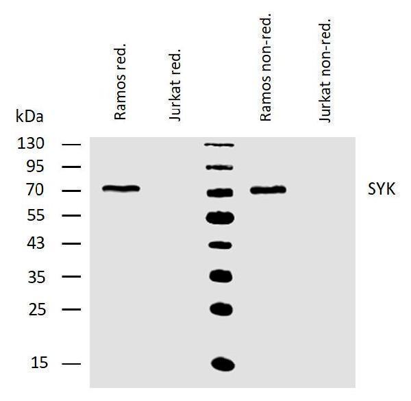 Western blotting analysis of human Syk using mouse monoclonal antibody SYK-01 on lysates of Ramos and Jurkat (negative control) cells under reducing and non-reducing conditions